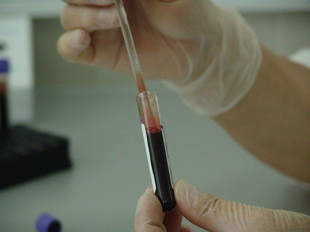 В случае удачного окончания научной работы, препарат может поступить в медучреждения.