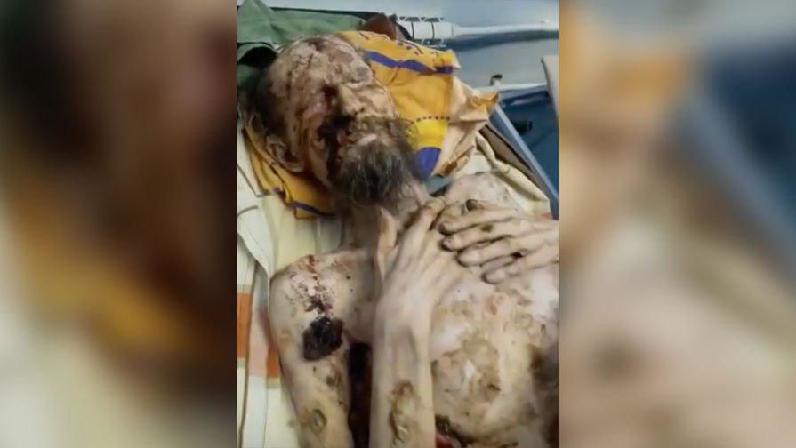 Мужчина выжил в медвежьей берлоге.