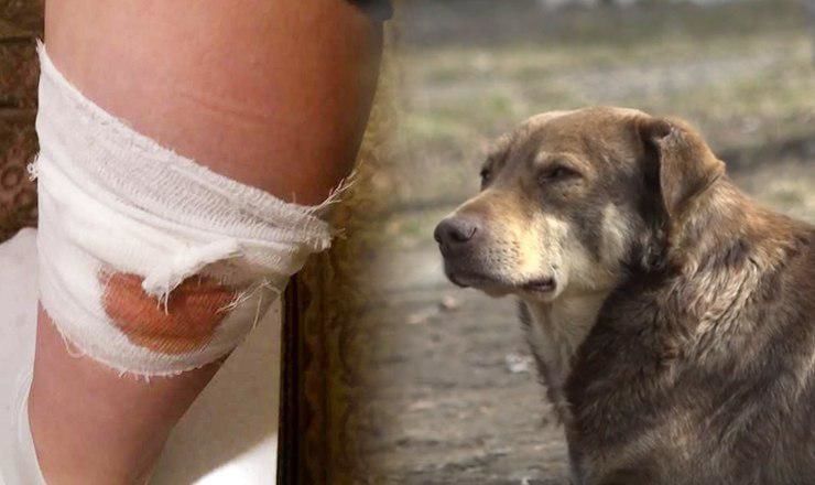 В Бельцах стая бездомных собак набросилась на женщину. 