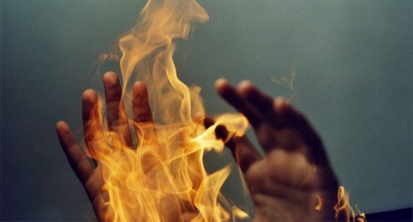 Житель Джолтая получил тяжелые ожоги, разжигая печь.