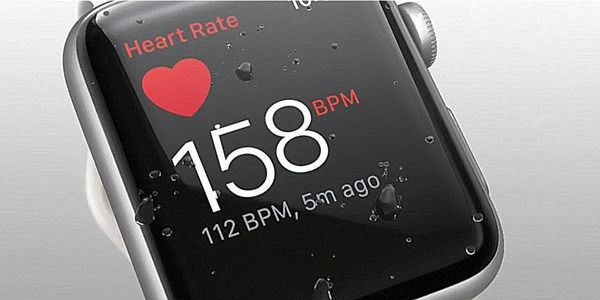 Apple Watch определяют аритмию с точностью 97%