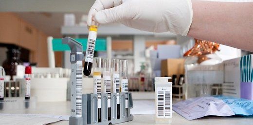 Пик заболеваемости гриппом в текущем сезоне ожидается в феврале.