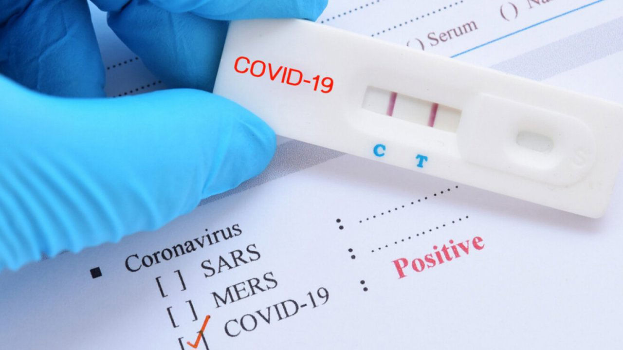 Молдова пока не будет вводить тесты COVID-19 для путешественников из Китая.