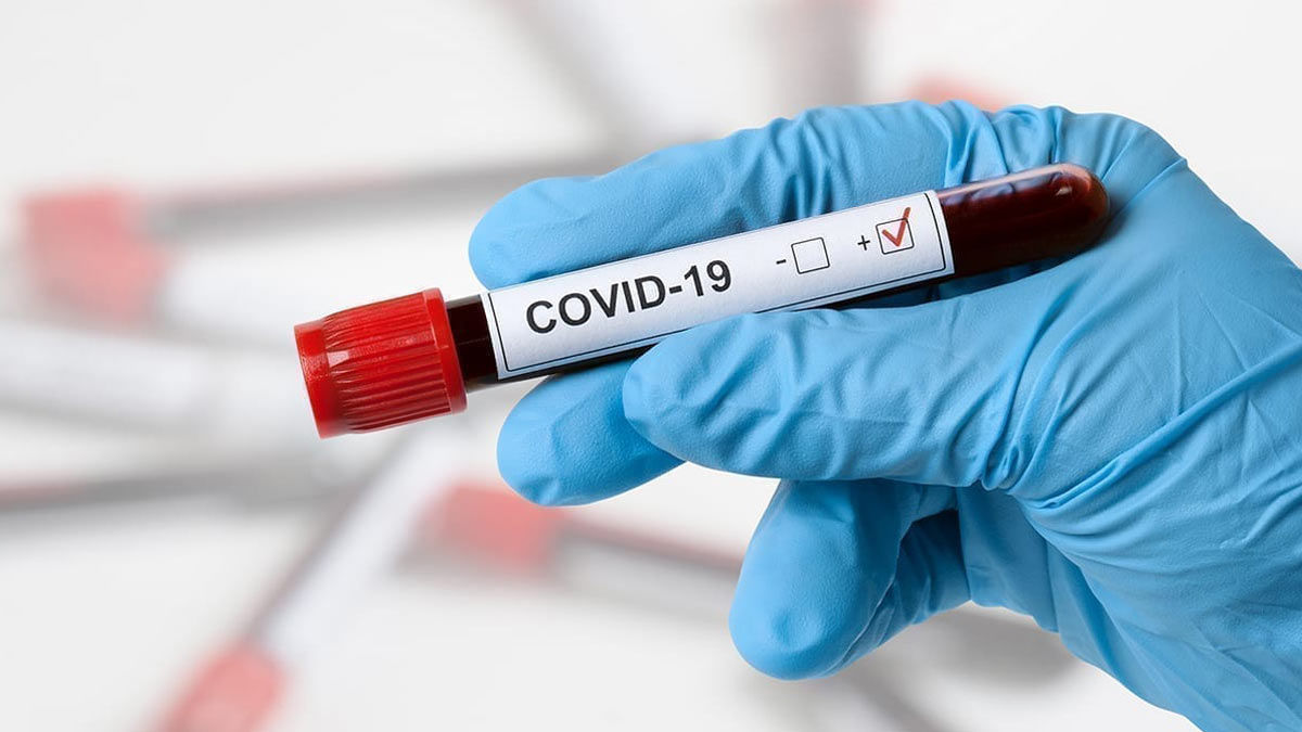 В Молдове зарегистрировали 304 новых случая COVID-19.