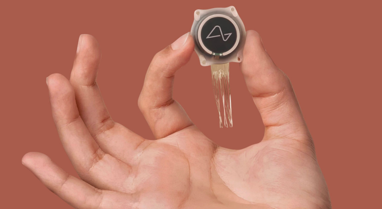Un nou implant provoacă concurență pentru Neuralink și intră în faza testelor clinice.