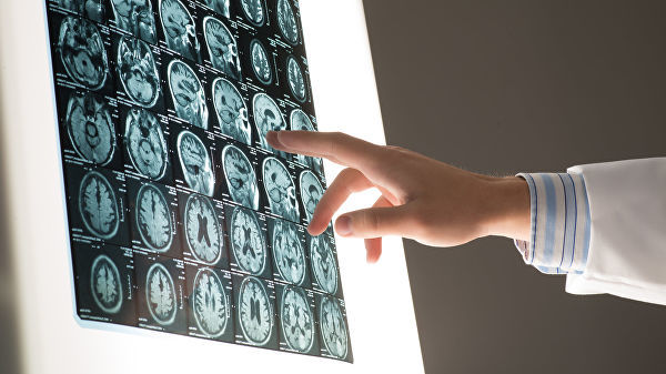 Ученые проанализировали данные 9652 человек из проекта UK Biobank Study.