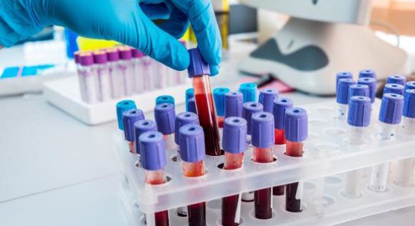 Sportivii s-au îmbolnăvit brusc la sosirea controlorilor antidoping.