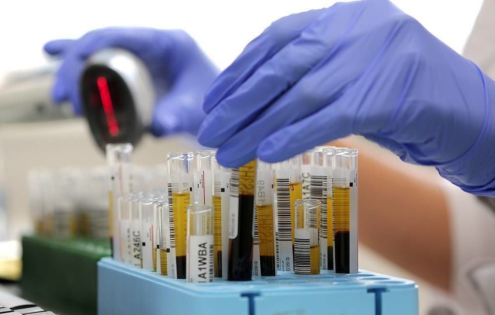 В Дании обнаружили менее чувствительную к вакцине мутацию коронавируса.