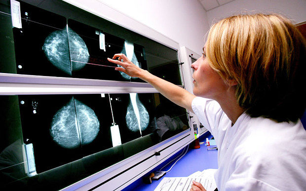 Cancerul, pe locul doi după cauzele de deces în Chișinău. Foto: bucurestifm.ro