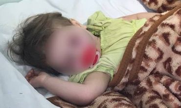 Ce spun medicii despre micuța de 2 ani din Sângerei, bătută cu bestialitate.