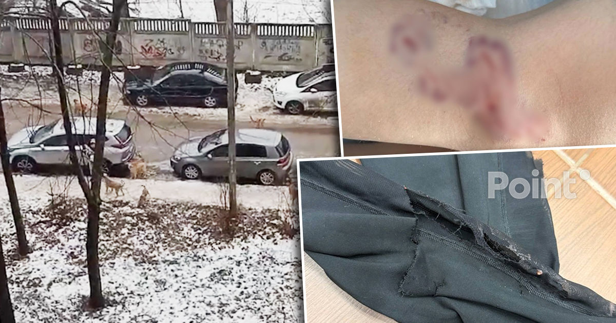 В Кишиневе стая собак напала на девушку.