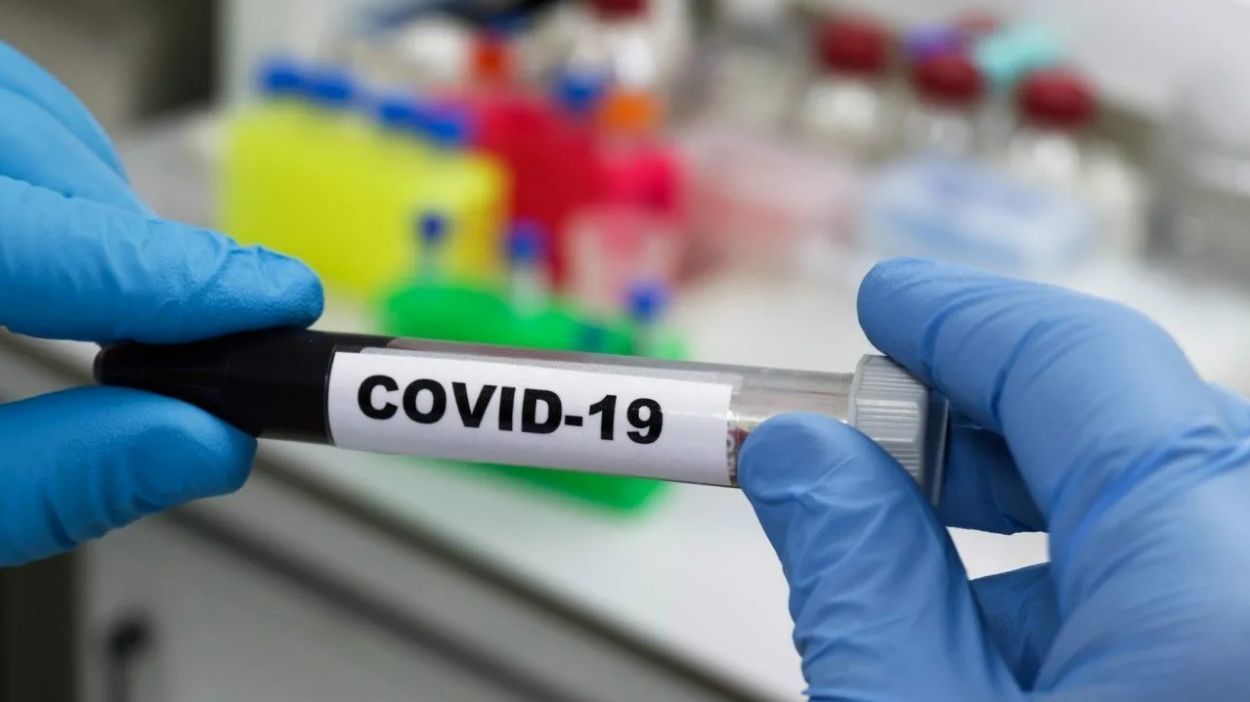 В Молдове зарегистрировали 1565 новых случаев COVID-19