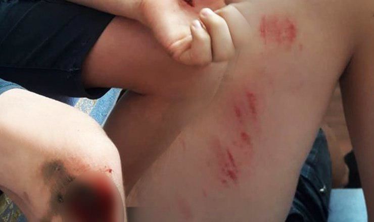 В Бельцах свора собак напала на 12-летнего мальчика.
