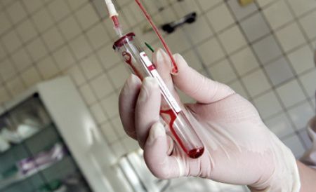 Infectările cu HIV în Europa, adesea detectate prea târziu.