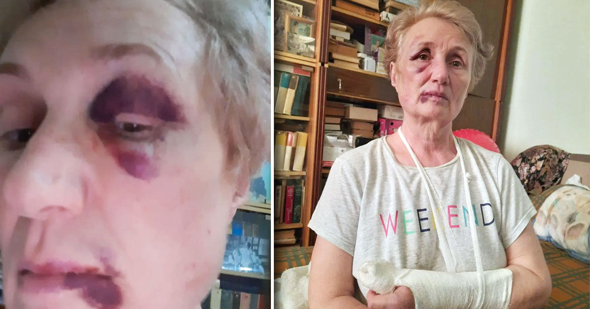 O femeie, bătută în plină zi în Capitală: Mă lovea cu bastonul metalic.