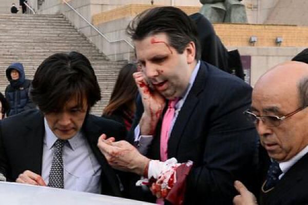Ambasadorul Statelor Unite în Coreea de Sud, Mark Lippert, a fost rănit de un bărbat înarmat cu o lamă de ras joi la Seul, potrivit poliției și televiziunii, transmit Associated Press și France Presse.