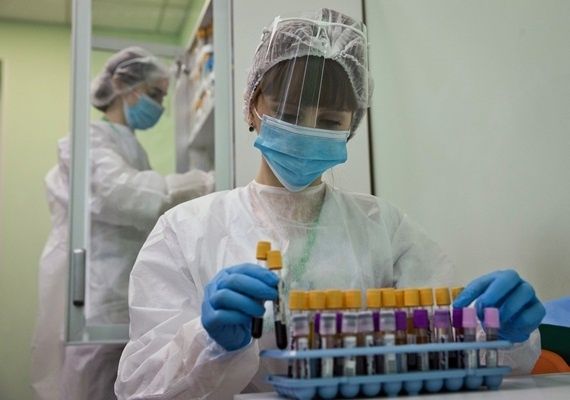 Иммунолог назвал массовым психозом популярность тестов на антитела к коронавирусу.