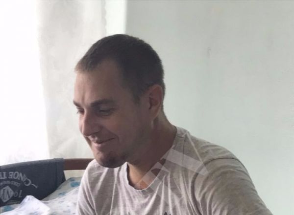  Врачи прооперировали мужчину с диагнозом "опухоль челюсти".