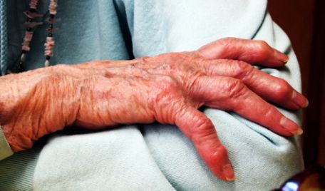 O bătrână de 83 de ani din satul Cubani, raionul Glodeni a trecut prin chinuri groaznice. A fost bătută cu bestialitate şi apoi ar fi fost abuzată sexual.
