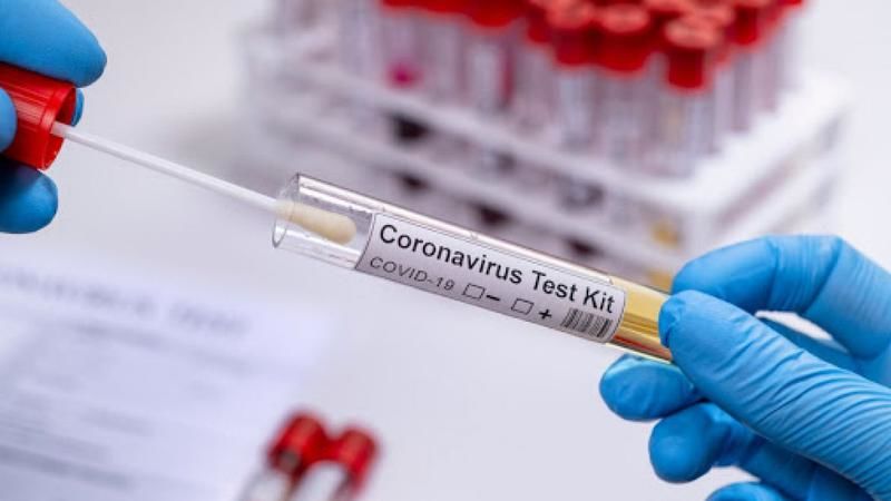 COVID-19: В Молдове самый высокий уровень положительных тестов в Европе.