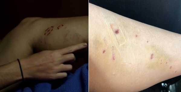 Хладнокровие помогло биологу вырваться из пасти трехметрового крокодила.