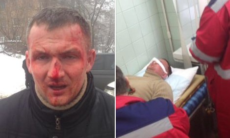 В Киеве жестоко избили депутата Рады.
