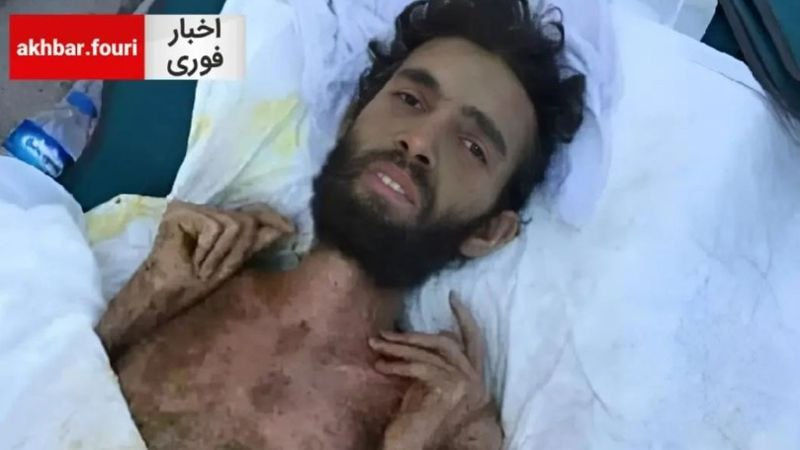 Истощённого сирийца достали из-под завалов спустя три месяца после землетрясения.