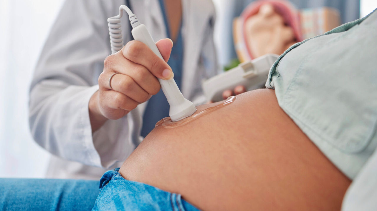 Studiu: Cezariană crește riscul de apariție a cancerului la copil.