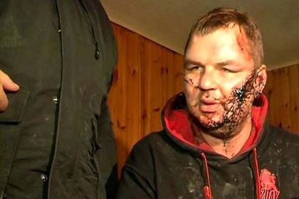 Дмитрия Булатова обнаружили 30 января в поселке под Киевом. Фото: argumentua.com