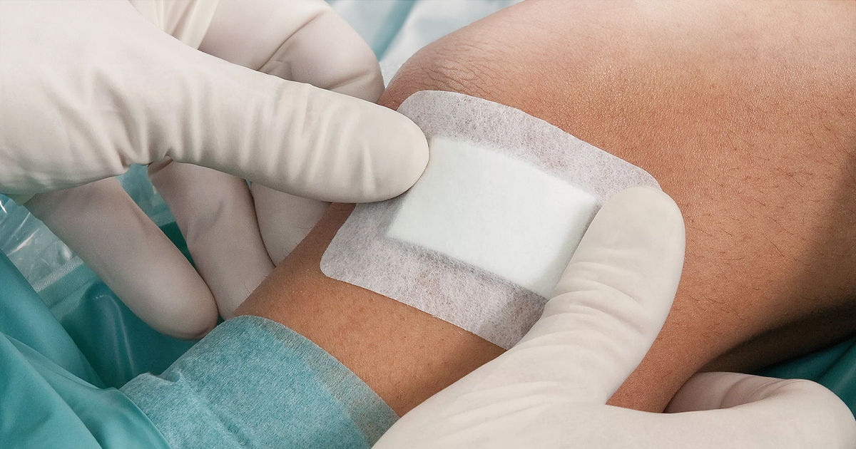 Cercetătorii au creat pansamente unice realizate din nanoflori care accelerează vindecarea rănilor.