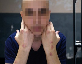 Un tânăr, condamnat că a lovit un poliţist cu o umbrelă, a fost eliberat după 10 luni de detenţie. 