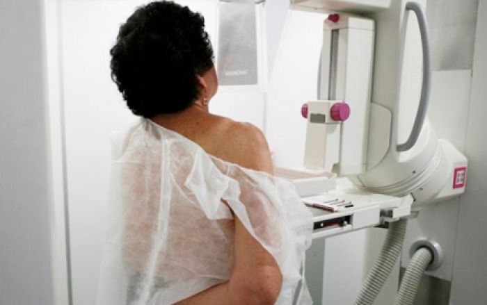 Specialistul mai spune că majoritatea femeilor care se adresează tâziu la medic vin din mediul rural.