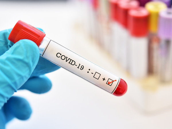 Минздрав: Число случаев COVID-19 продолжает идти на спад.