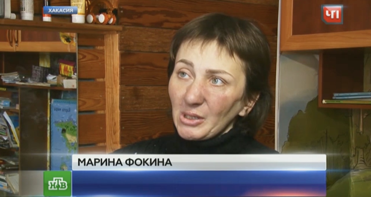 Выжившая в схватке с медведем женщина пытается восстановить изуродованное лицо.