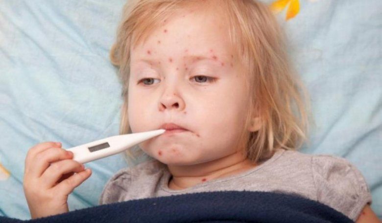 Doar 88 la sută dintre părinți își vaccinează copiii contra rujeolei