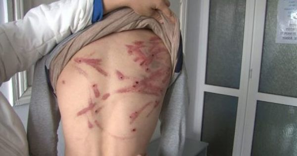 В Ниспоренском районе отец избил сыновей проволокой.