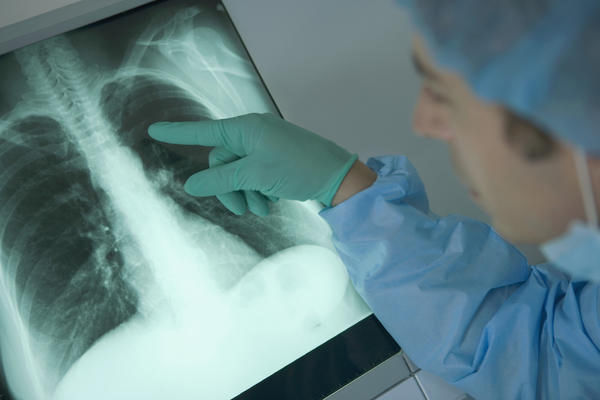 Peste 3.300 de moldoveni s-au îmbolnăvit de tuberculoză în 2017