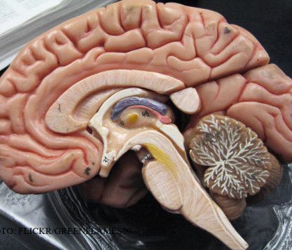 Studiu arată că dacă saracia micsoreaza creierul, bogatia il mareste la loc. Foto: protv.md