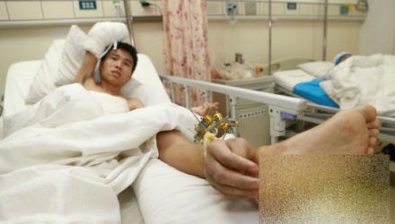 Medicii din China au salvat un om de invaliditate.