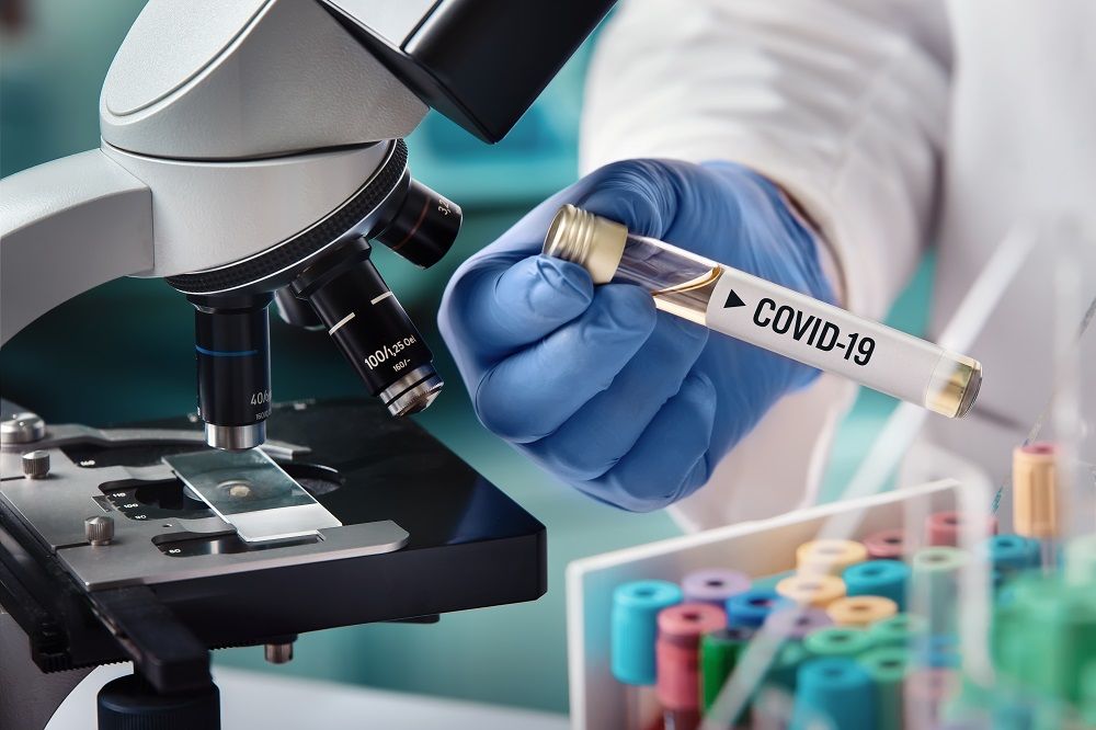 В Молдове зарегистрировали 233 новых случая COVID-19.