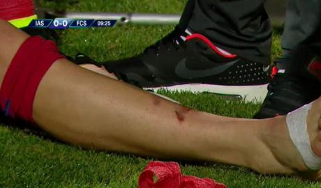 Un fotbalist moldovean de la Iaşi l-a accidentat grav pe unul al Stelei Bucureşti. Foto: digisport.ro