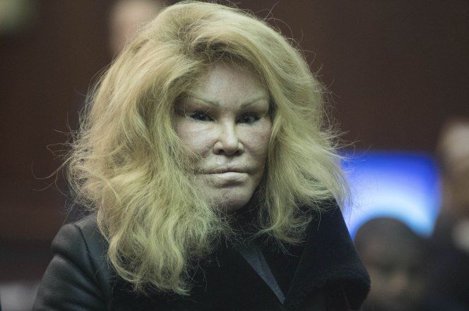 76-летняя фанатка пластических операций Джослин Вильденштейн.
