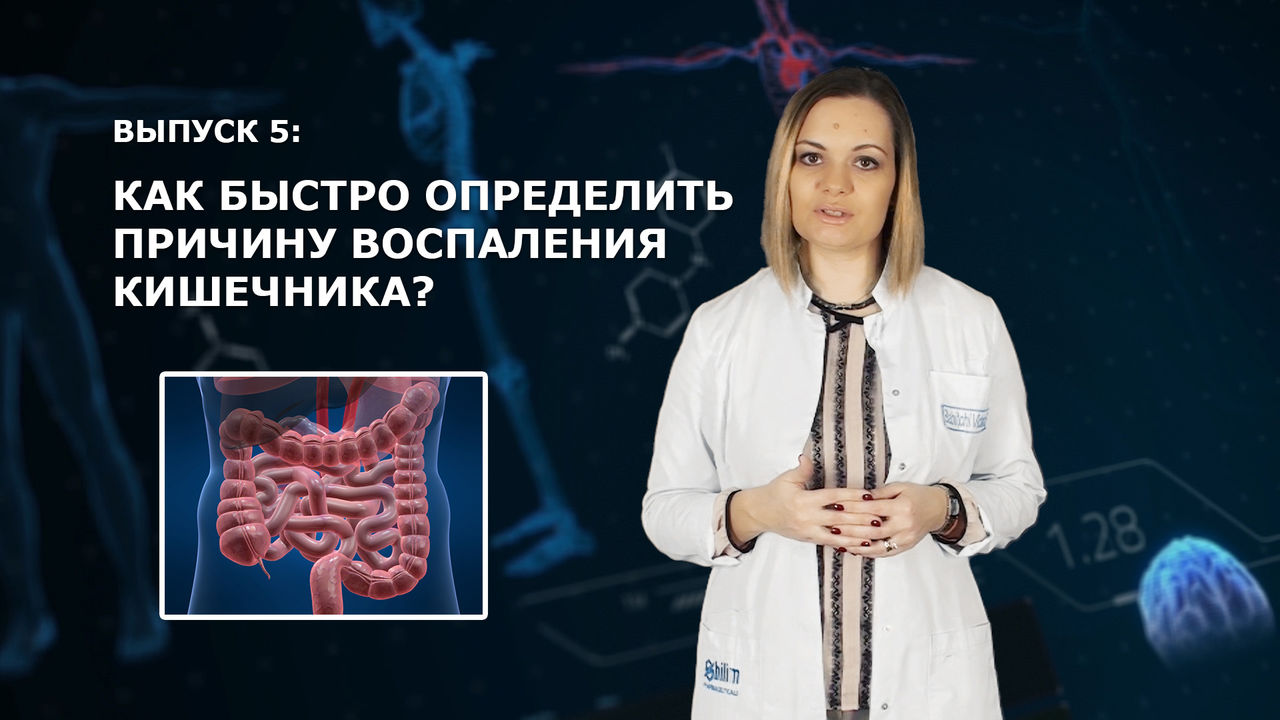 Как быстро определить причину воспаления кишечника.