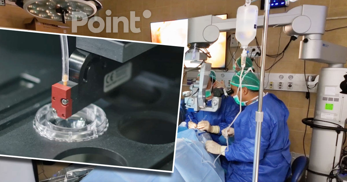 Medicii israelieni au reușit pentru prima dată să restabilească vederea cu ajutorul unei cornee artificiale.