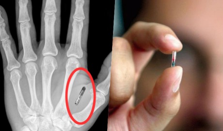 Angajaţii unei companii din Statele Unite vor avea implantate microcipuri în mână. Foto: hackread.com