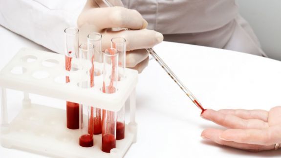 Responsabilii unui spital din China au admis că instituţia se face vinovată de infectarea accidentală cinci persoane cu HIV. Foto: agora.md