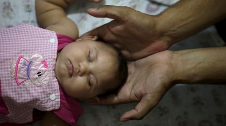 Primul copil din Europa cu malformații provocate de virusul Zika s-a născut în oraşul Barcelona din Spania.