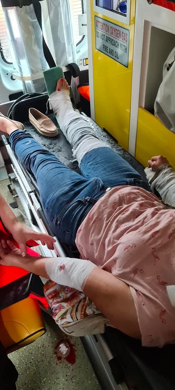 На Буюканах на пешеходном переходе сбили двух человек, включая ребенка