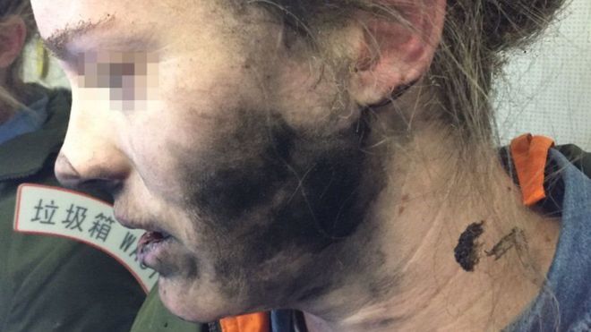 У пассажирки во время полета взорвались наушники
