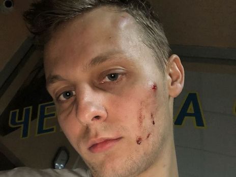 В Киеве избили сына депутата Рады от "Оппозиционного блока"